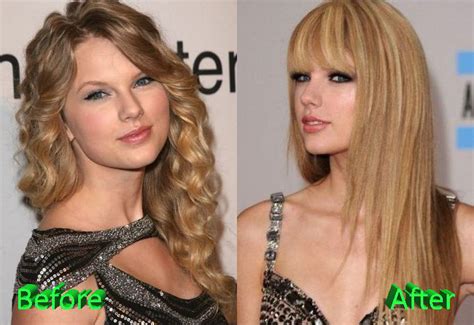 did taylor swift have a breast augmentation|Taylor Swift Was Slammed With Plastic Surgery Rumors After  .